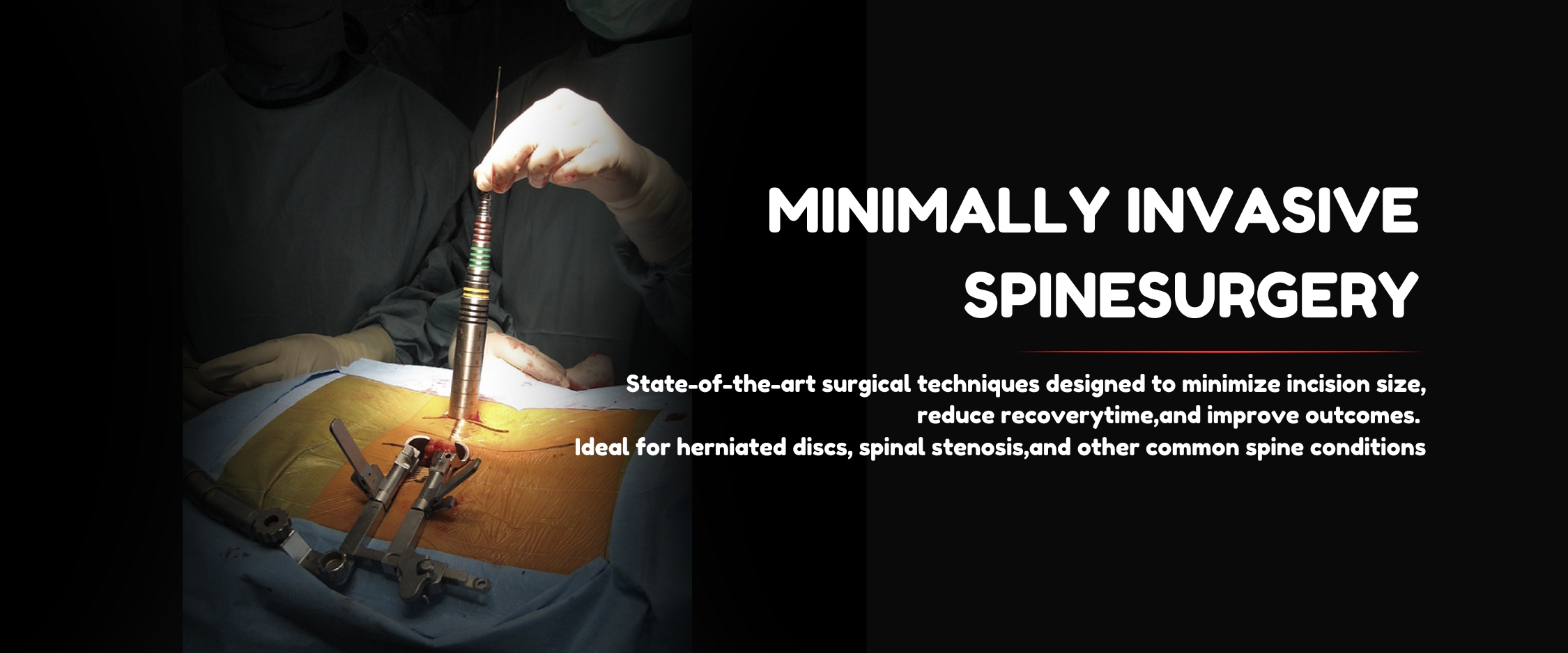 ENDOSCOPIC SPINE SURGERY (2)